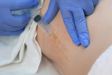Ozonio na barriga em São Paulo